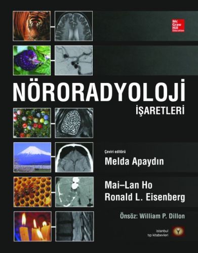 Nöroradyoloji İşaretleri (Ciltli)