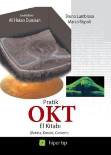 Pratik OKT El Kitabı (Retina, Koroid, Glokom)